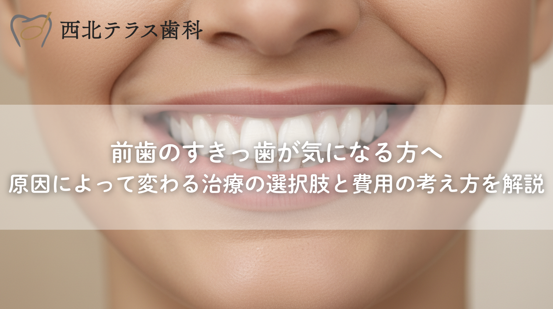 前歯のすきっ歯が気になる方へ｜原因によって変わる治療の選択肢と費用の考え方を解説