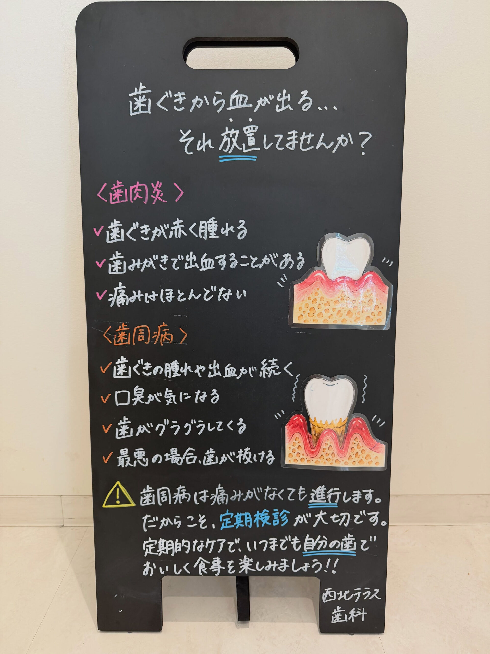 🩸歯みがきのたびに血が出ていませんか？