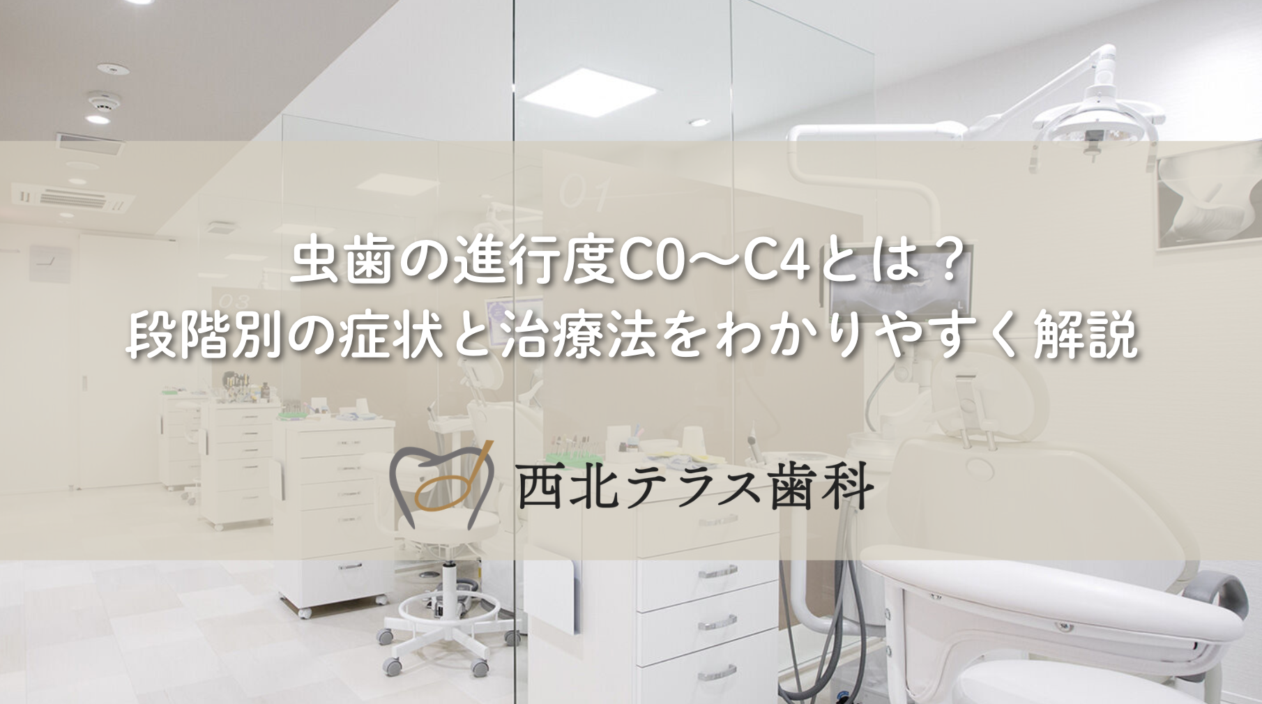 虫歯の進行度C0〜C4とは？段階別の症状と治療法をわかりやすく解説