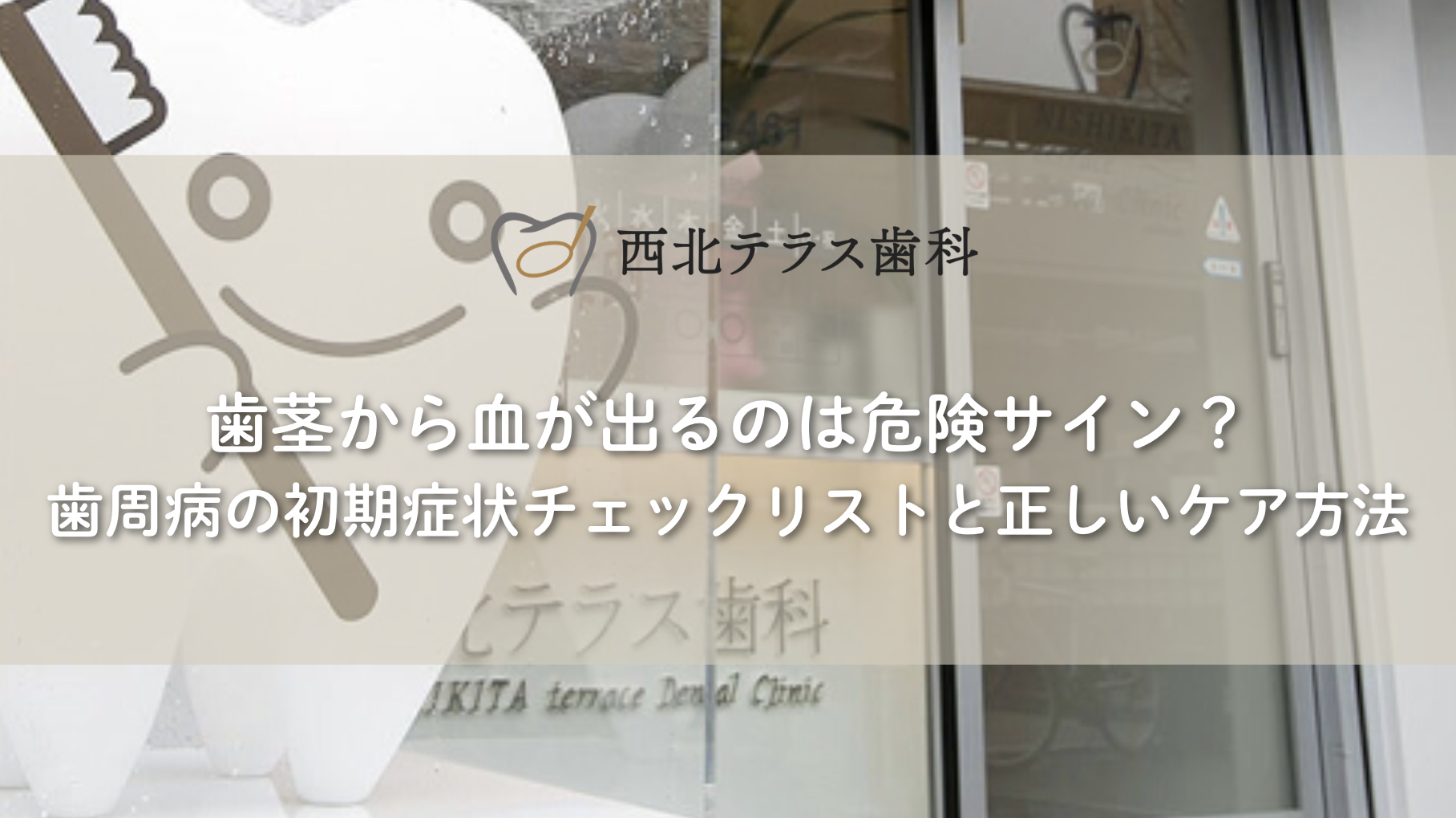 歯茎から血が出るのは危険サイン？歯周病の初期症状チェックリストと正しいケア方法