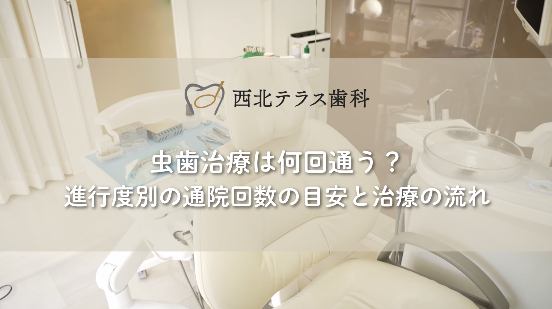 虫歯治療は何回通う？進行度別の通院回数の目安と治療の流れ
